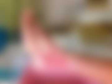 Swędzi mnie noga!!!