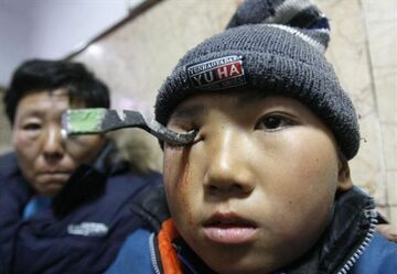 Nadział się w szkole na poręcz