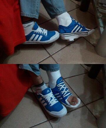 Gips na kostce? Żaden problem