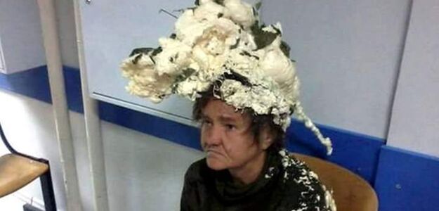 Chciała ułożyć włosy. Wylądowała w szpitalu