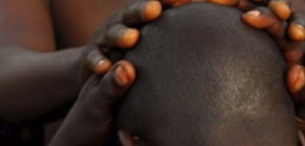 W Mozambiku czarownicy polują na łysych mężczyzn