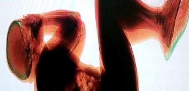 Prześwietlili śpiącego pijaka na taśmie podajnika do bagażu