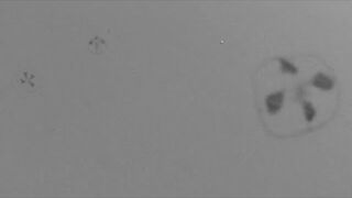 Meduzy słodkowodne / Fresh water jellyfish