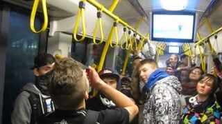 Podpalił sobie twarz gazem. Tak się bawi gimnazjum.